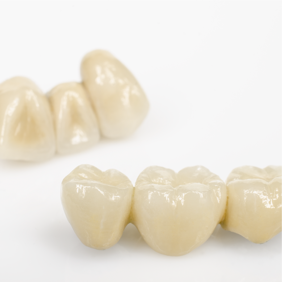 What Are Wisdom Teeth? All you should know about Wisdom Teeth