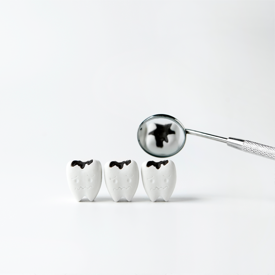 Best Fluoride Toothpaste for Cavity Protection