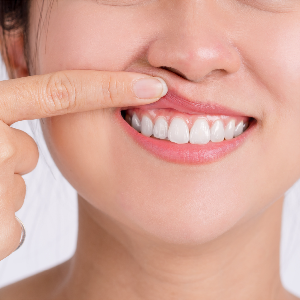 periodontal disease causes and symptoms how to detect early