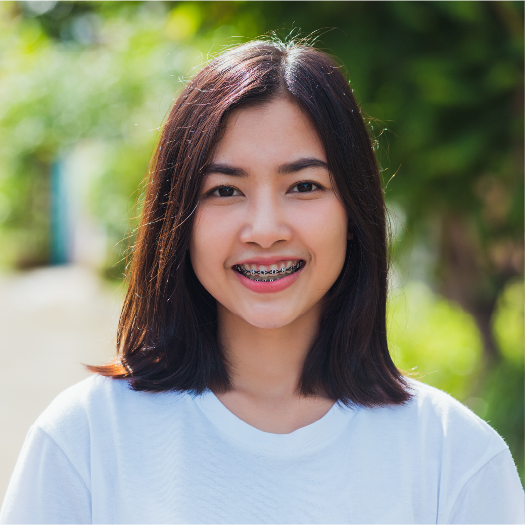 What Are the Different Types of Braces? Metal, Traditional & Other Orthodontic Options