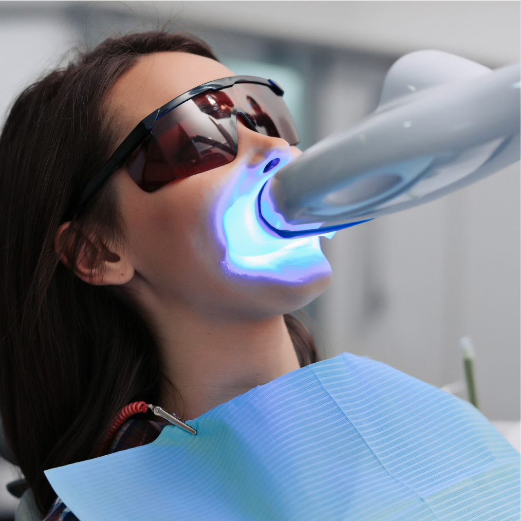 Teeth Bleaching Prices and Costs 2025 at the Dentist