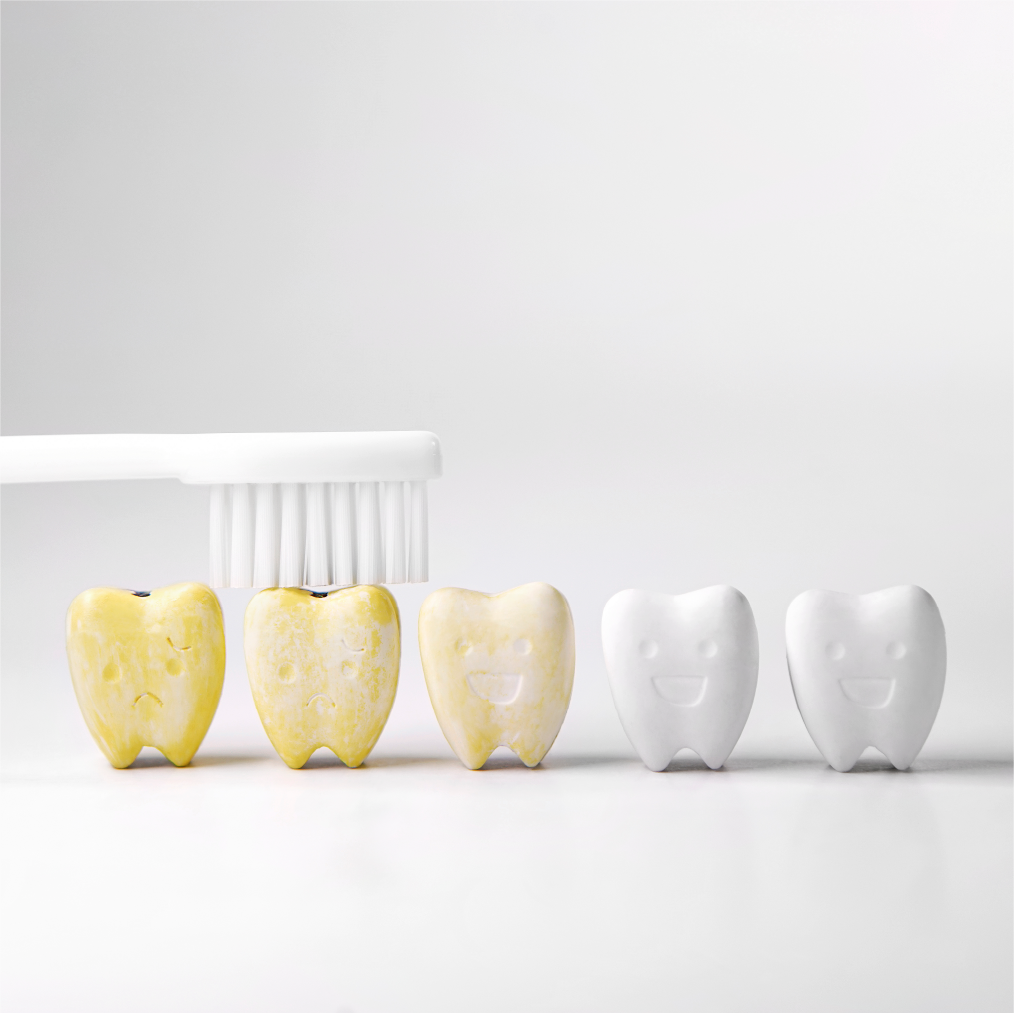 Why do I have yellow and stained teeth