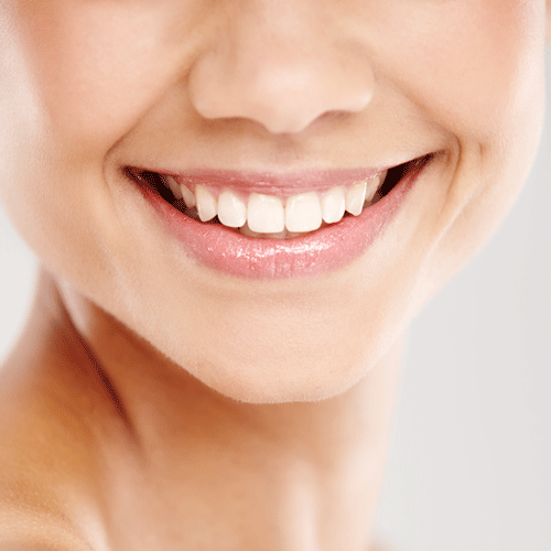 Retainer After Braces What You Should Be Doing Now
