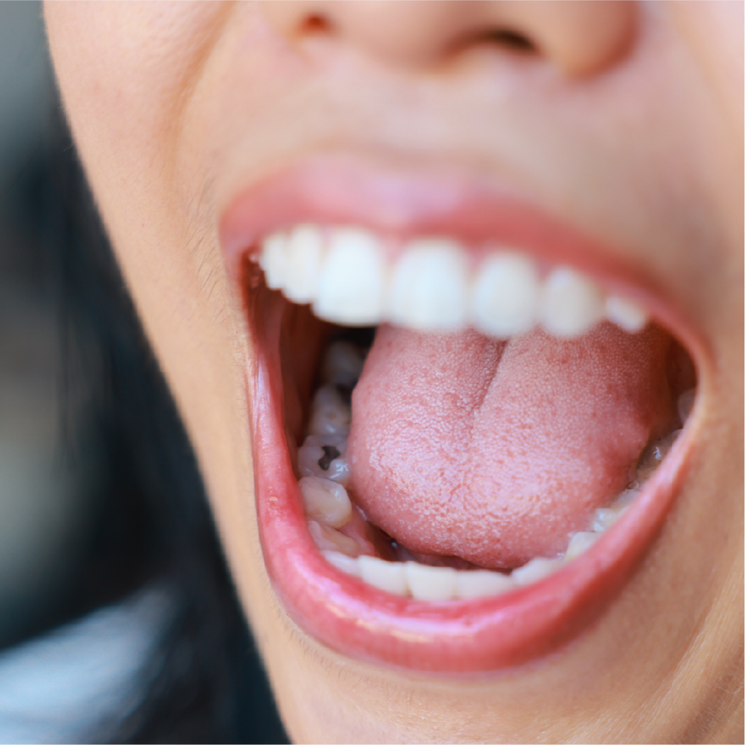 what to do with cavities 5 symptoms causes treatment and prevention