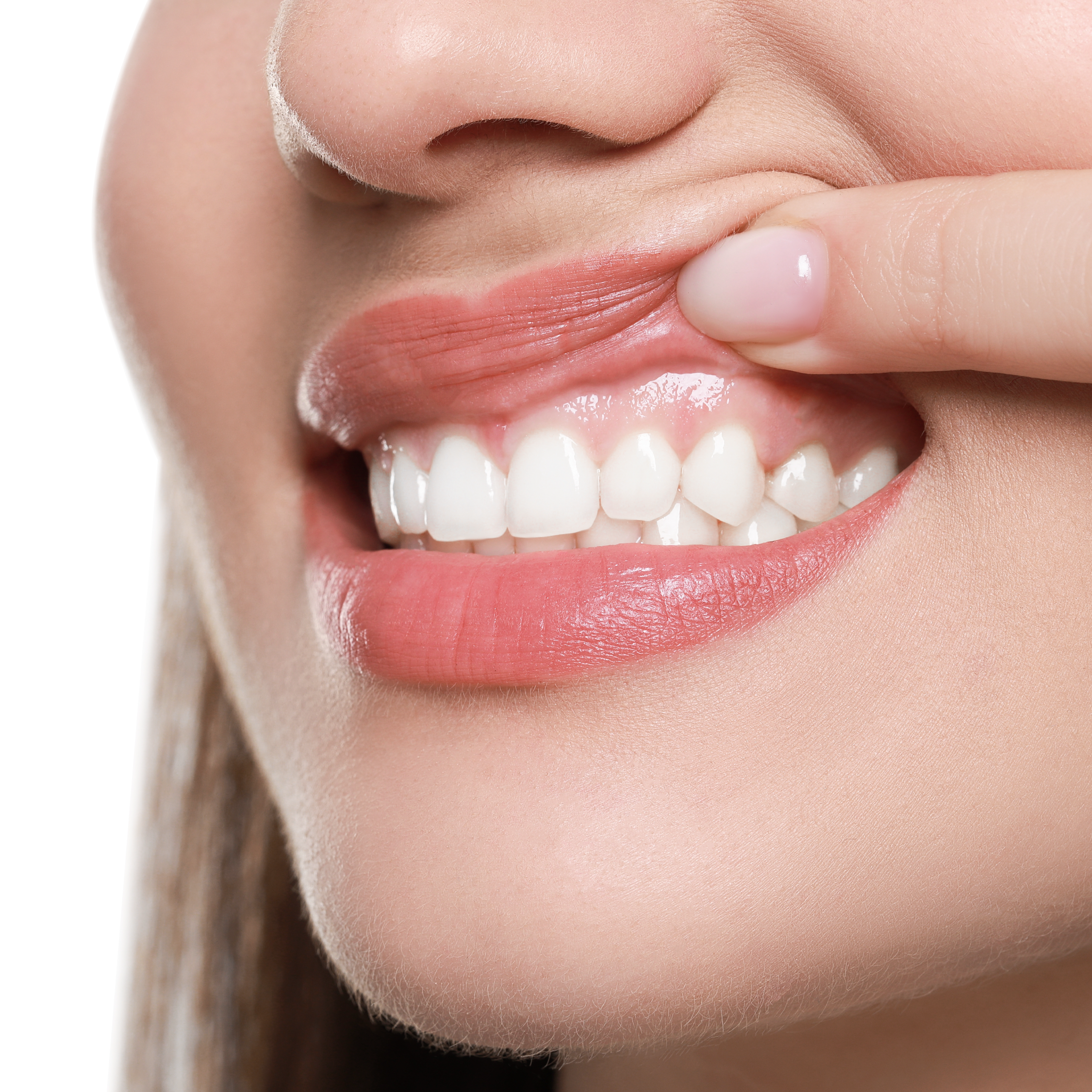 gum recession remedies causes early symptoms and solutions