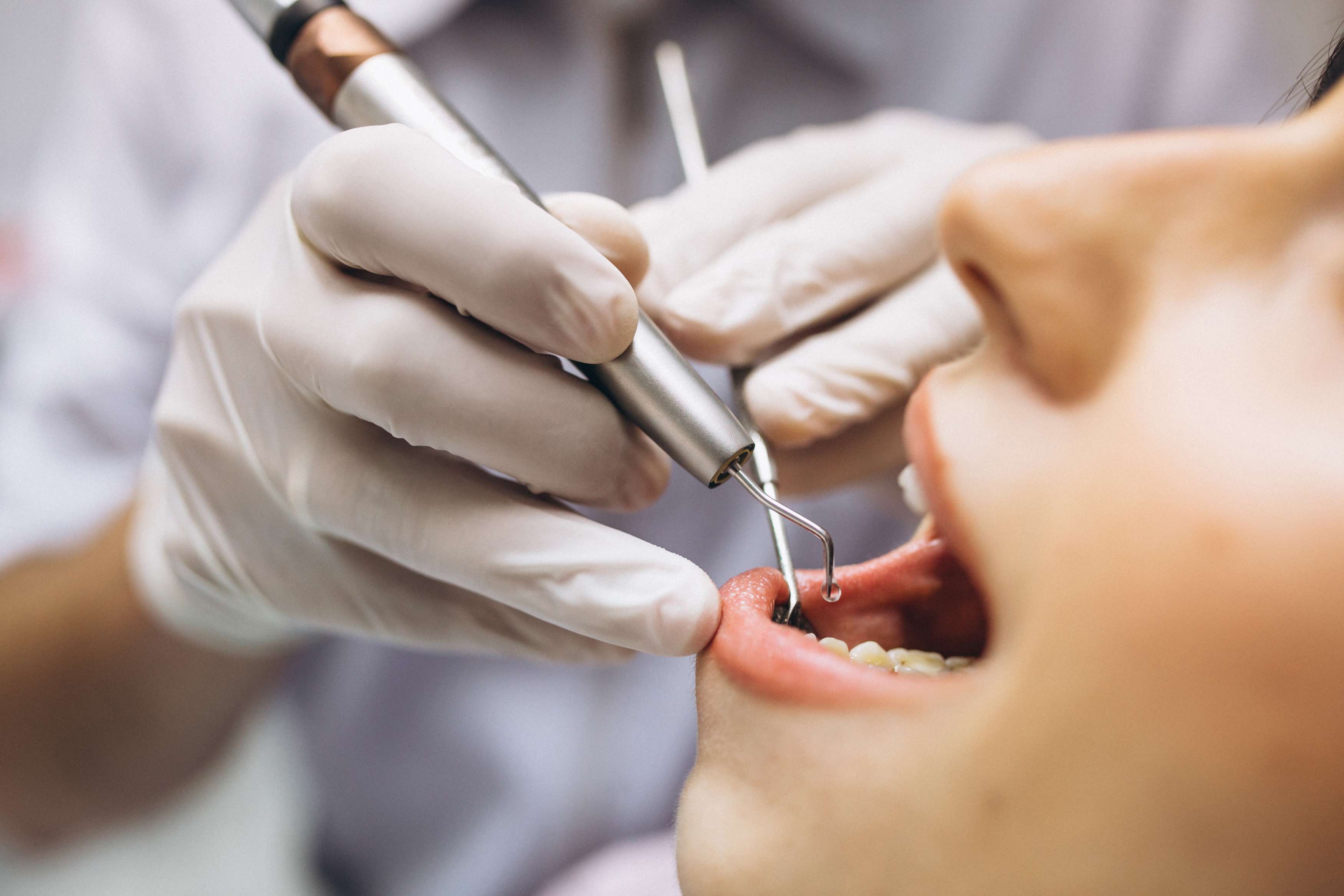 Dental Implant Pain What to Expect And Recovery Tips